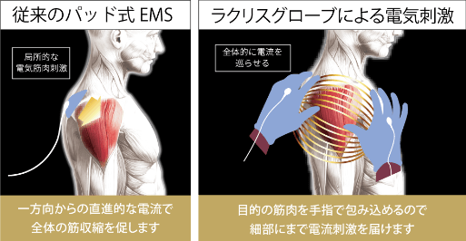 従来のパッド式ＥＭＳは一方方向からの直進的な電流で全体の筋収縮を促します。ラクリスグロープによる電気刺激は目的の筋肉を手指で包み込めるので細部にまで電流刺激を届けます。